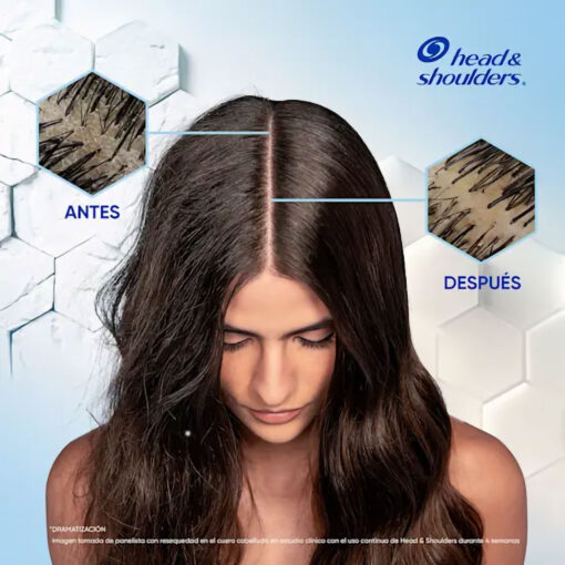 Shampoo Head & Shoulders  Anti Resequedad X 375 Ml - Imagen 6