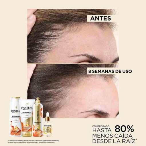 Crema para Peinar Pantene Pro V Miracles Anti Caída X 300 Ml - Imagen 4