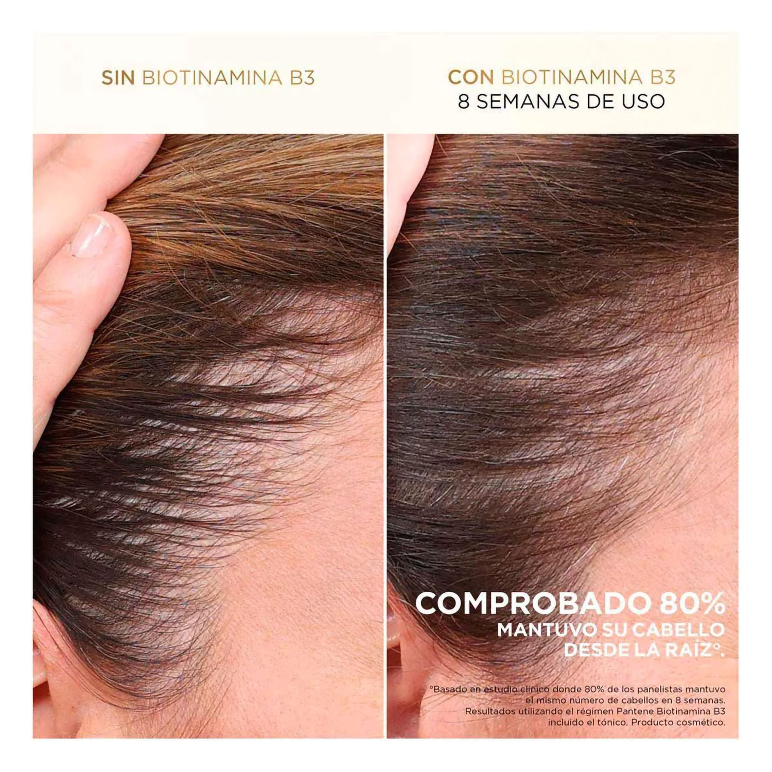 Acondicionador Pantene Pro V Miracles Anti Caída X 510 Ml - Imagen 6